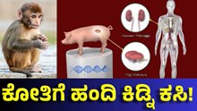 ವೈದ್ಯಕೀಯ ಅಚ್ಚರಿ: ಹಂದಿ ಕಿಡ್ನಿ ಕಸಿಯ 2 ವರ್ಷದ ನಂತರವೂ ಬದುಕುಳಿದ ಮಂಗ!  ವೈದ್ಯಕೀಯ ಅಚ್ಚರಿ: ಹಂದಿ ಕಿಡ್ನಿ ಕಸಿಯ 2 ವರ್ಷದ ನಂತರವೂ ಬದುಕುಳಿದ ಮಂಗ!