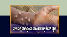 BREAKING : ದೇಶದಲ್ಲಿ ಮತ್ತೊಂದು ಮಂಕಿಪಾಕ್ಸ್ ಕೇಸ್ ದೃಢ.. ಸೋಂಕಿತರ ಸಂಖ್ಯೆ 4ಕ್ಕೆ ಏರಿಕೆ BREAKING : ದೇಶದಲ್ಲಿ ಮತ್ತೊಂದು ಮಂಕಿಪಾಕ್ಸ್ ಕೇಸ್ ದೃಢ.. ಸೋಂಕಿತರ ಸಂಖ್ಯೆ 4ಕ್ಕೆ ಏರಿಕೆ